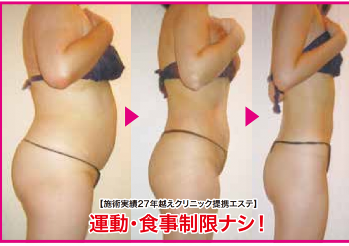 その他のエステ - クリニック提携サロン 琥珀〜KOHAKU〜 筑紫野
